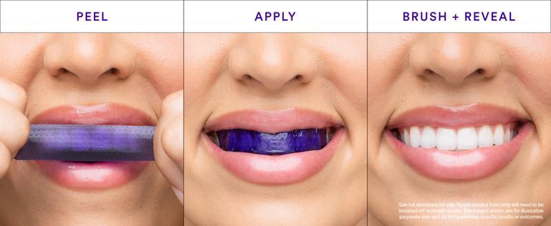HiSmile Whitening Strips, Teeth Whitening Strips, Purple Tooth Whitening, Tooth Stain Treatment, Combining Whitening and Colour Correction