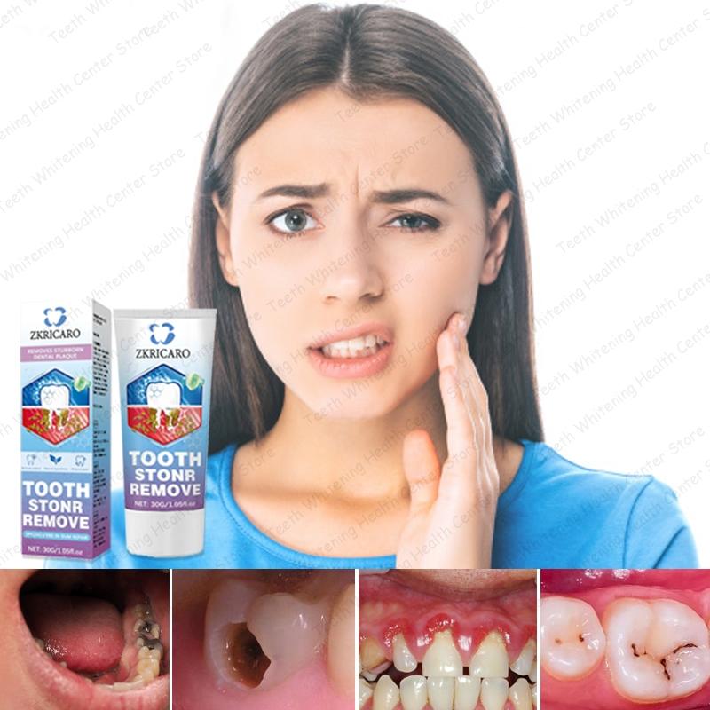 ZKRICARO Anti-Cavity Repair Toothpaste FDA Certified Cavity Repair Whitens Teeth Strengthens Enamel Relieves Sensitivity & Bad Breath