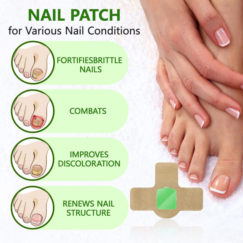 Lansiyi Nail Care Patches, 21pcs/box Nail Health Care Patches with 5 Herbs for Solving Nail Problems, NailSupplies, Daily Care Nails Kit Set, Nail Tech Supplies,Self Care Tools Matte Japanese