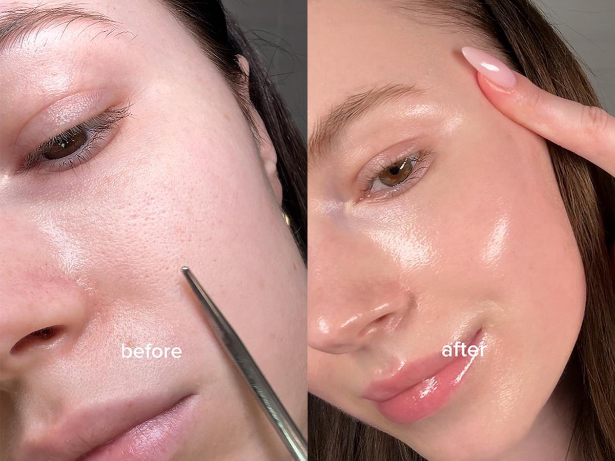 [FRANKLY] PDRN Bounce Ball Serum | 99% Pure Salmon DNA Moisturizer for Skin Repair & Glow Skin | Barrier Repair, Glow Skin, Plumping Effect, Korean Skincare, Lightweight