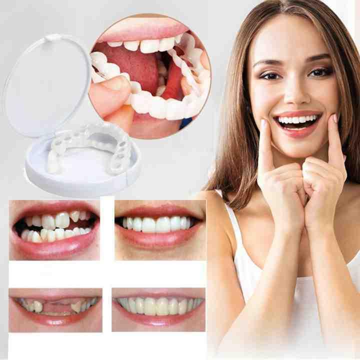 Instant Smile Cosmetic Veneers - 3/6PCS Non-Medical Snap-On Teeth, Perfect for a Flawless Photo Look, Reusable & Adjustable Fit