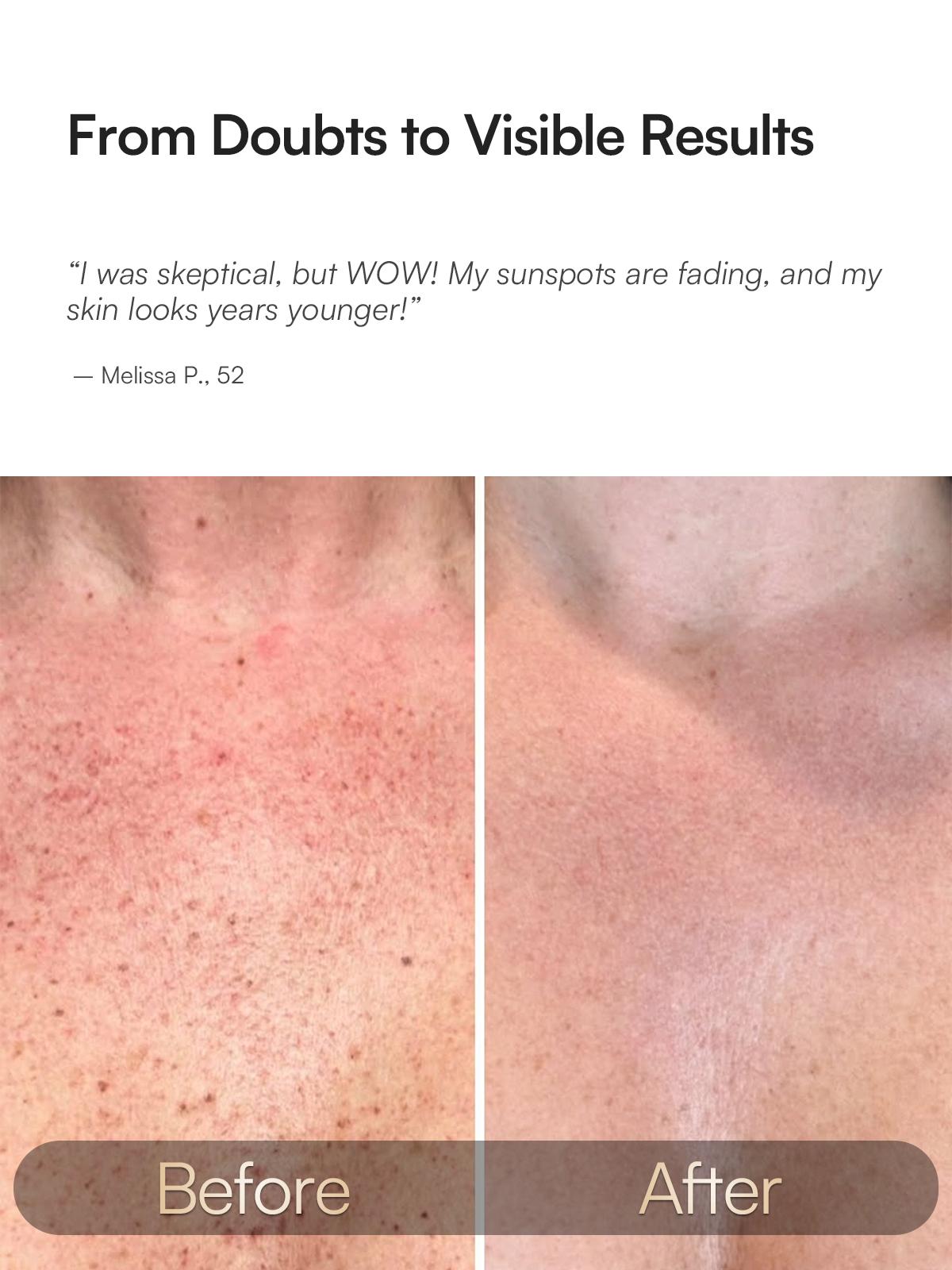 INIA GLOW Neck & Chest Red Light Mask – 850nm NIR | Fade Wrinkles & Spots | Lift & Firm in 4 Weeks - Red Light Skincare Device with 2600mAh Rechargeable Controller, Clinic-Grade, Full Coverage