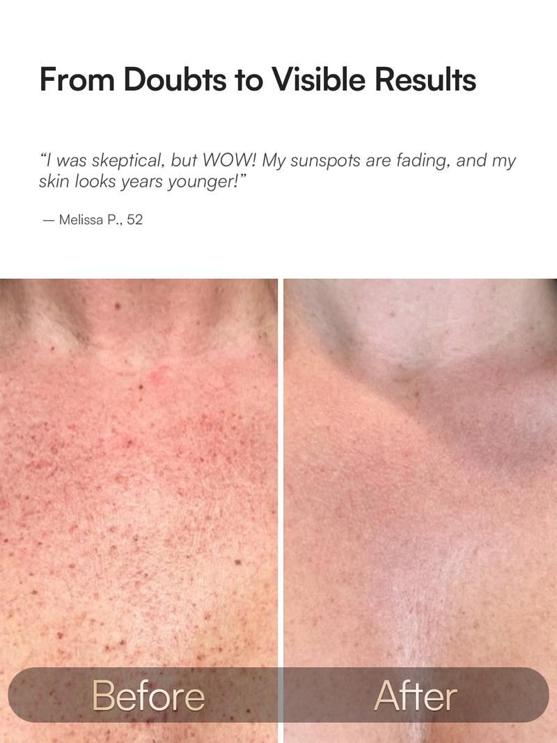 INIA GLOW Neck & Chest Red Light Mask – 850nm NIR | Fade Wrinkles & Spots | Lift & Firm in 4 Weeks - Red Light Skincare Device with 2600mAh Rechargeable Controller, Clinic-Grade, Full Coverage