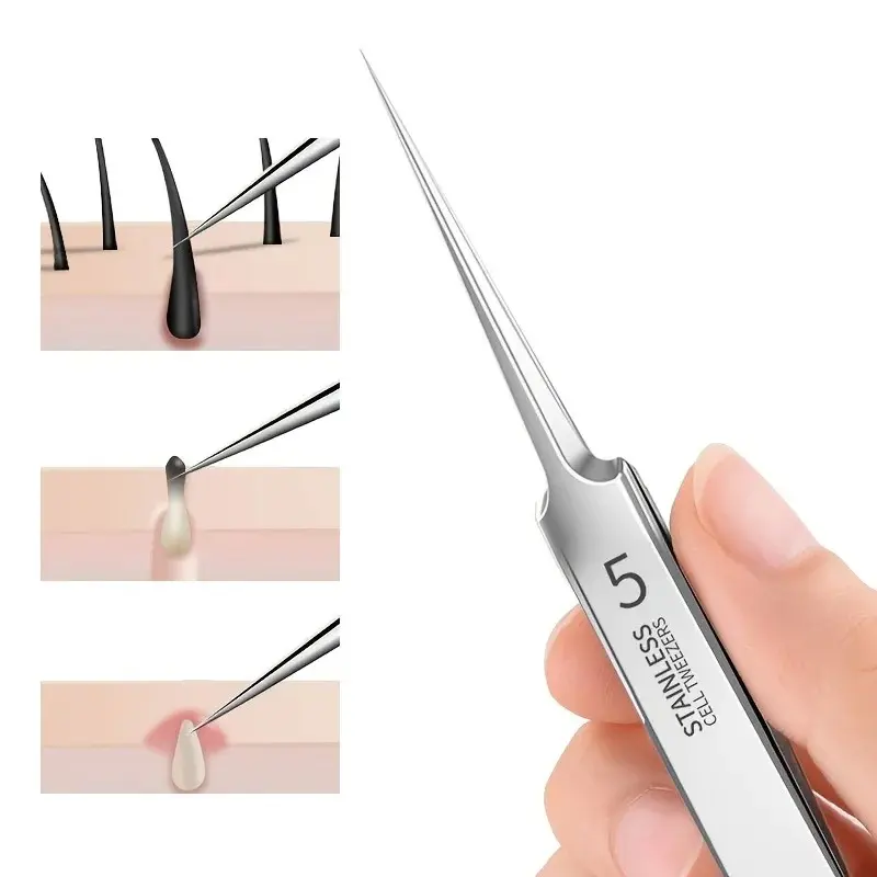 Blackhead Removal Tweezers, Stainless Steel Effective Comedones Extractor, Whiteheads Removal Deep Cleansing Tools, Pore Tweezer Tools, Facial Care Tools, Skin Care Beauty Tools