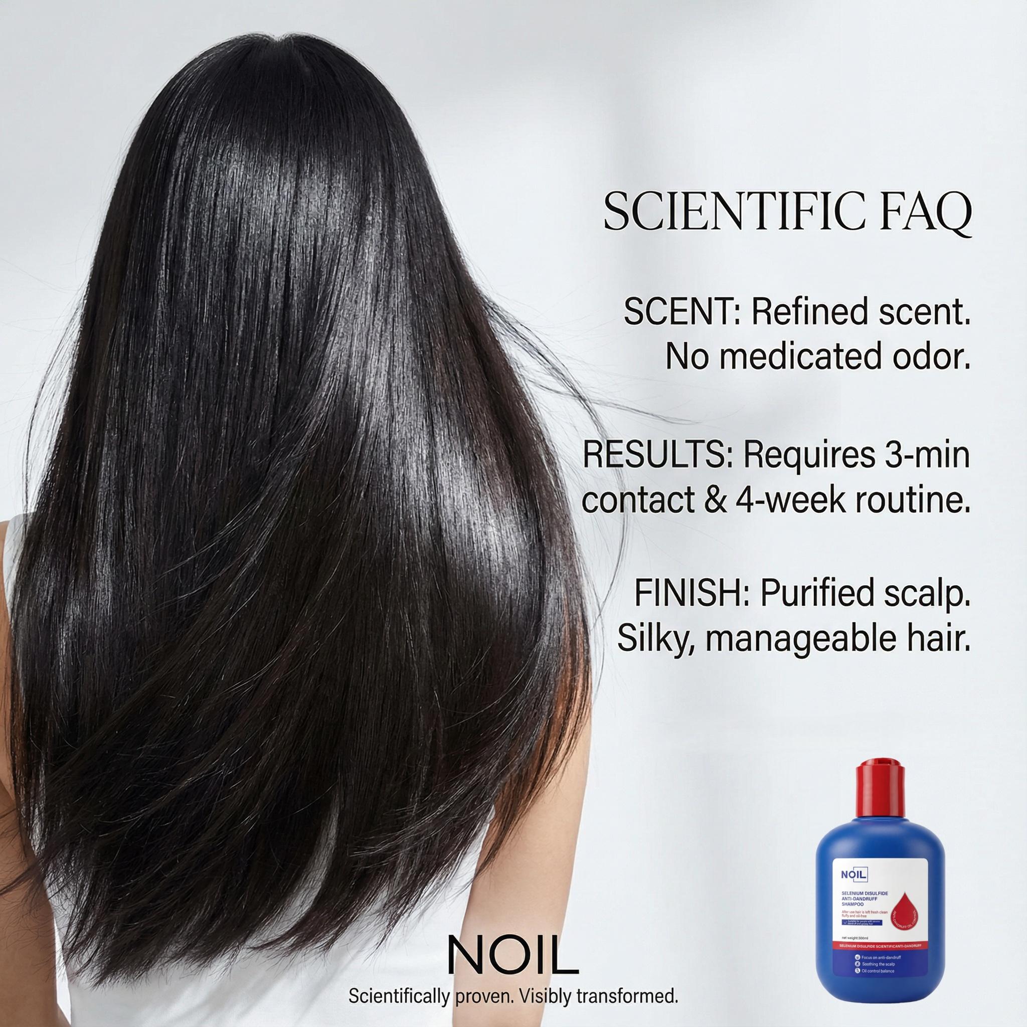 NOIL Selenium Disulfide Hair Care Shampoo Oil Control Refreshing Anti-Dandruff Anti-itch Scalp Cleansing Shampoo, 300ML