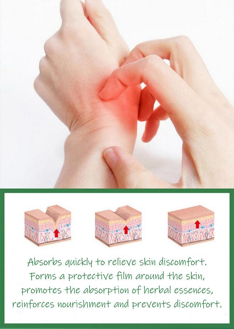 Umex Soothing & Relief Cream with Honeysuckle & Peppermint 30g 100% Natural Plant Extracts Gentle for All Ages Fast Acting Relief for Itching Hydrates Dry Sensitive Skin Therapeutic Treatment for Eczema Psoriasis - Wellness
