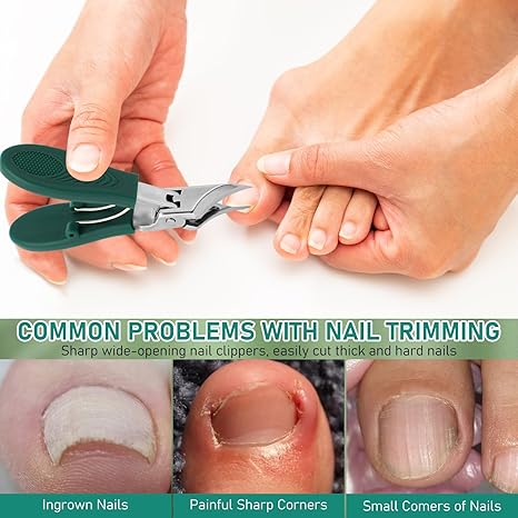 Eagle Beak Beveled Nails Clippers, 3-Piece Sets of Wide Jaw Opening Anti-Splash Slanted Nail Clipper, Oblique Ingrown Toenails Clipper, for Thick Nails and Ingrown Care