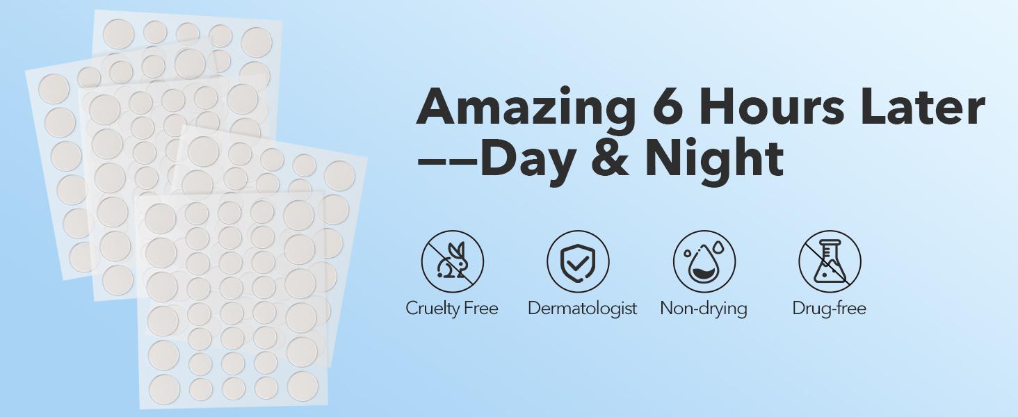 QUSTERE Pimple Patches for Face, Hydrocolloid Acne Patches, Cute Round Shape Zit Covers, Spot Stickers with Tea Tree, Salicylic Acid & Cica Oil| 2 Sizes (9mm, 12mm) |288 Count  Skincare Clear