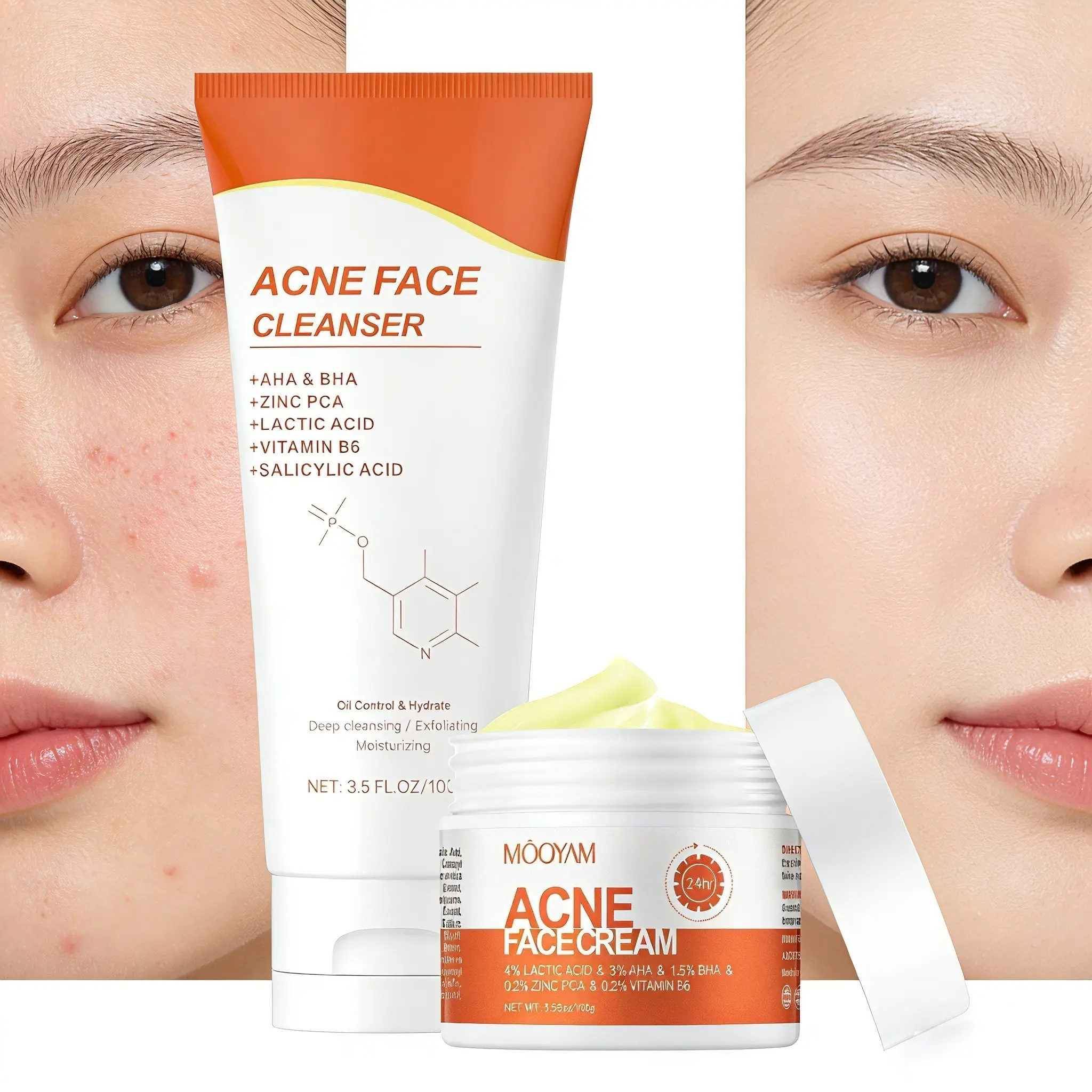 MOOYAM Acne Scar Treatment Cream 100ml Centella & Snail Repair Cream Post-Acne Marks Removal Acne&Pimple Treatment Fragrance Free Paraben Free Skincare Salicylic Skin Repair Sensitive Teens Scent free skincare Healthcare Aroma  acne clearing products