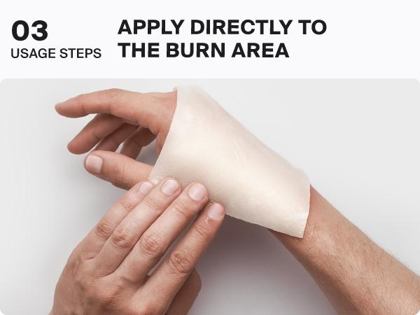 SURVIVEX Burn Dressing Kit with Tea Tree Oil - Hydrogel Burn Pads, Cooling Gels, Non-Adhesive Dressings & Gauze - Complete First Aid for Instant Cooling, Soothing & Relief SURVIVEX Burn Dressing Kit with Tea Tree Oil - Hydrogel Burn Pads, Cooling Gels, Non-Adhesive Dressings & Gauze - Complete First Aid for Instant Cooling, Soothing & Relief