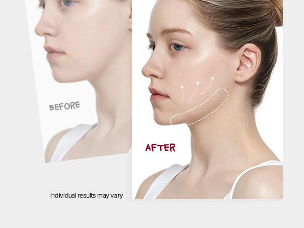 [Viral] Camellia Deep Collagen Chin Lifting Gel Mask – Zempic Neck Solution, Double Chin Reducer, Defined Jawline Shaper,  Firming, Jeju Camellia Ingredients for Skin Repair