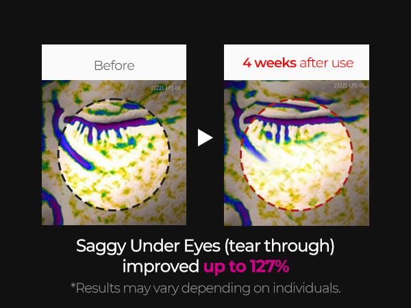 [Dr. Melaxin Official] Cemenrete Calcium Intense Cream | Anti-aging, Elasticity, Volume | Korean Cosmetic | 1.7 fl oz (50 ml)