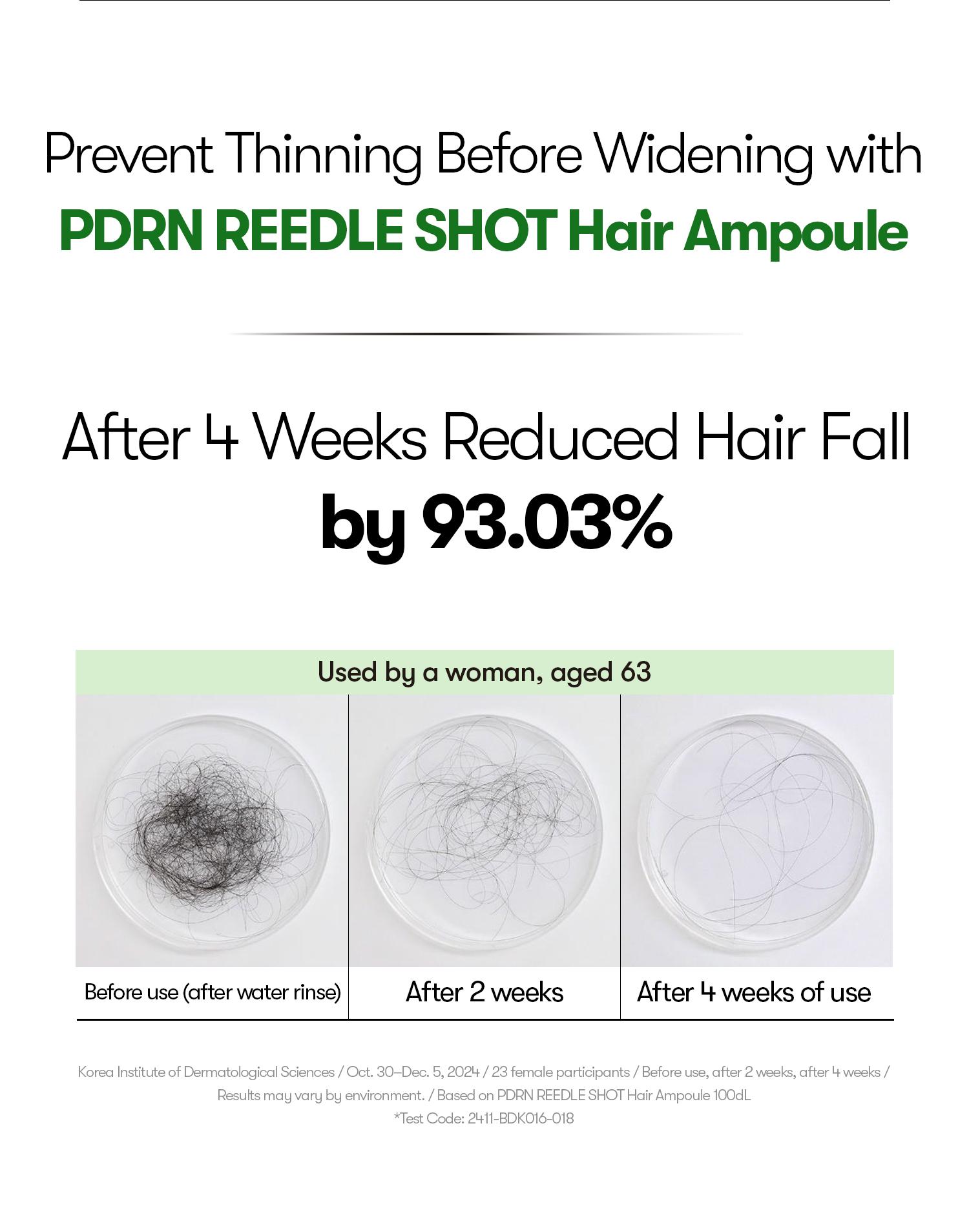 [VT Official] PDRN Reedle Shot Hair Ampoule | Hair Growth Hair loss treatment, Hair Loss Prevention, Scalp Health, OG Liquid Microneedling Reedle Shot, Enhanced Absorption Hair Serum Shot, PDRN & Caffein & Biotin & Rosemary Extract, Anti-aging Scalp No Ri
