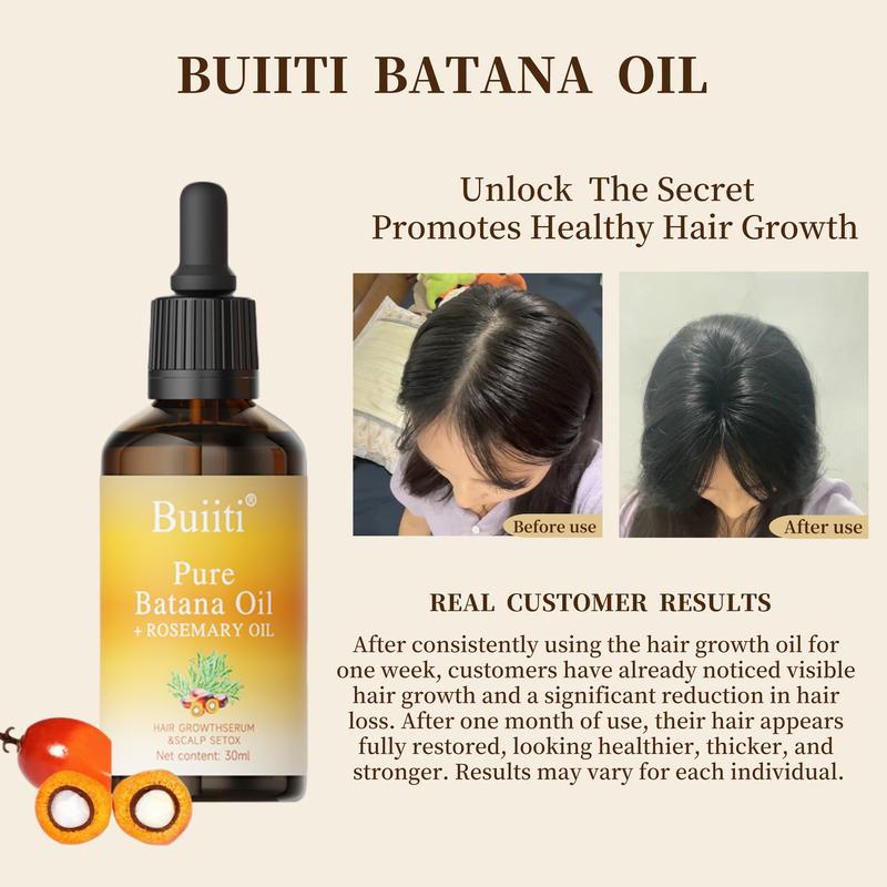 Buiiti Batana Oil with Rosemary - 30 mL Haircare for Nourishing Scalp & Detoxing for Strong, Healthy Hair
