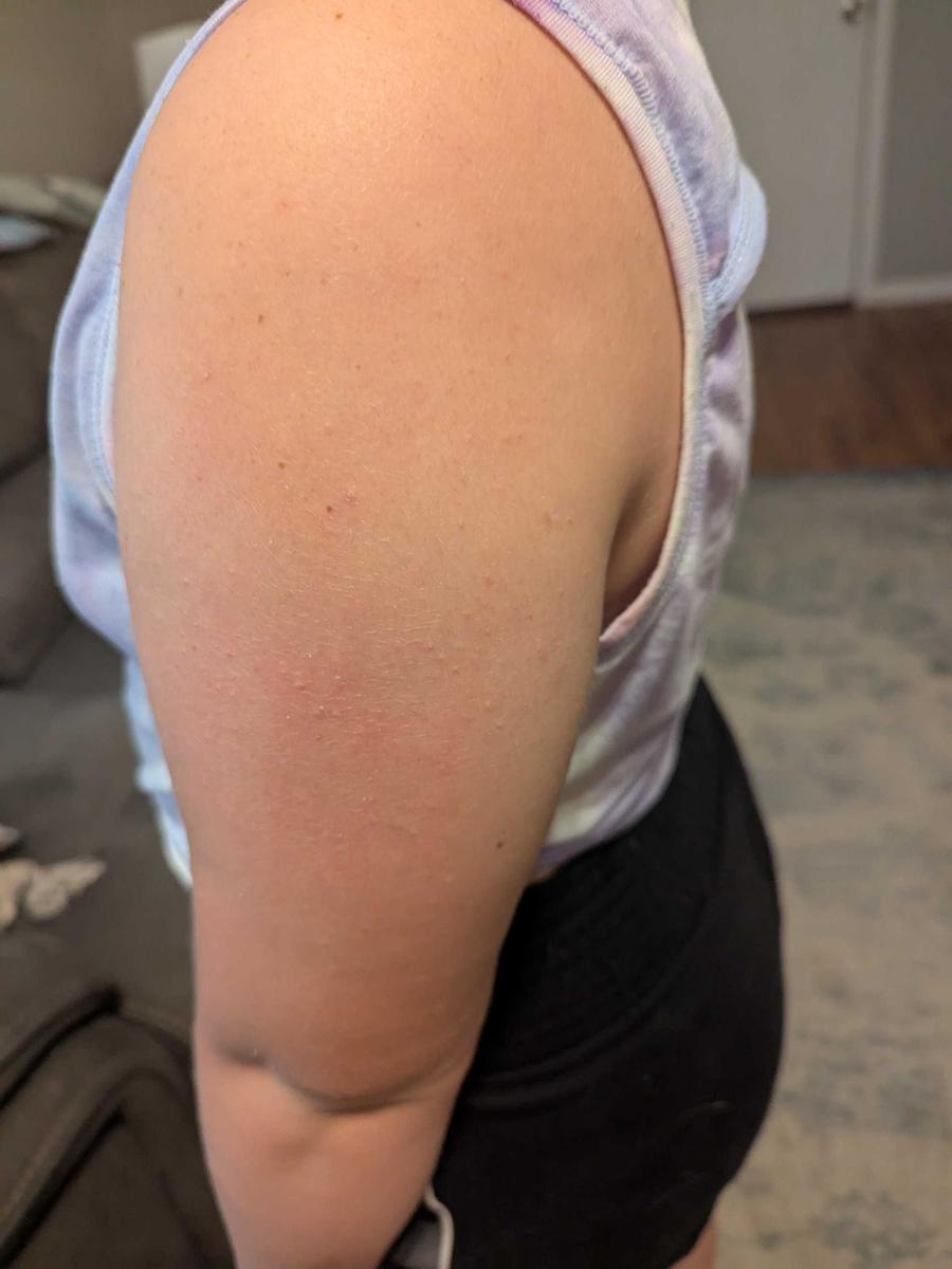 Item: Black Rice Peeling Ampoule + Body Peeling Spray