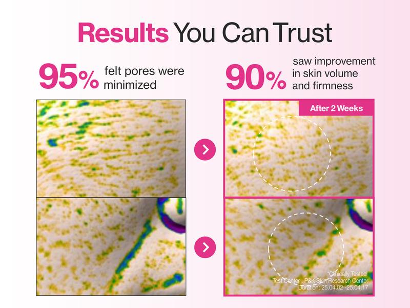 [numbuzin official shop] No.2 Overnight Face Mask | Rose PDRN Overnight Collagen Mask | Korean Glass Skin Essential | Elasticity, Hydrating, Firming, Enlarged Pores | Collagen, Peptides, PDRN | 37g, 4ea