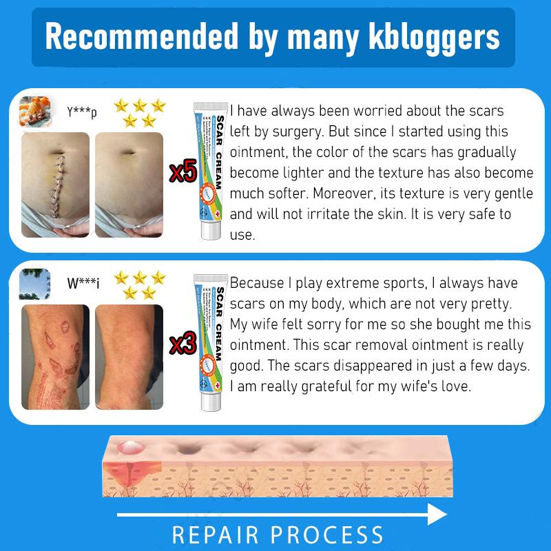 Scar Removal Cream & Gel for Effective Scarring Reduction - Fades Surgical & Acne Scars, Promotes Cell Regeneration, Lightweight Texture, Suitable for All Skin Types