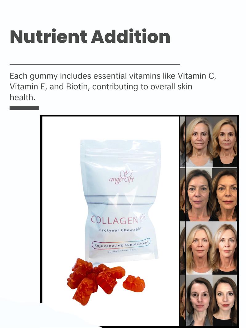 Protynal Colagen – Natural Edible Gummy Dietary Supplement for Beauty & Health! Protynal Colagen – Natural Edible Gummy Dietary Supplement for Beauty & Health!