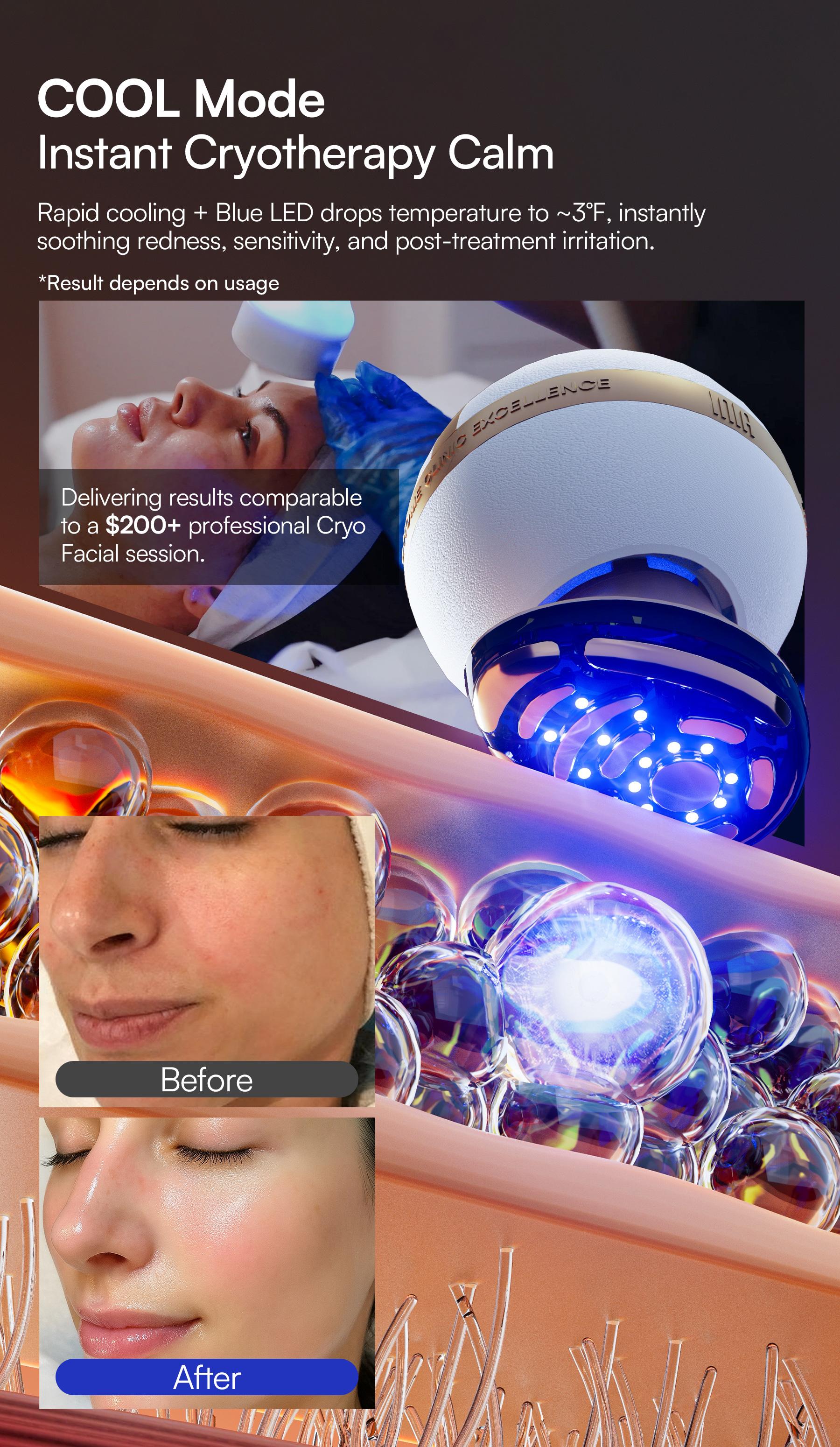 【LIVE EXCLUSIVE】INIA SPHERA At-Home RF & LED Anti-Aging Facial Device – Lift, Tighten & Sculpt with EMS Microcurrent, Red Light Therapy, Electroporation & Cryo Cooling for Firm, Glowing Skin. Perfect Black Friday Gift.