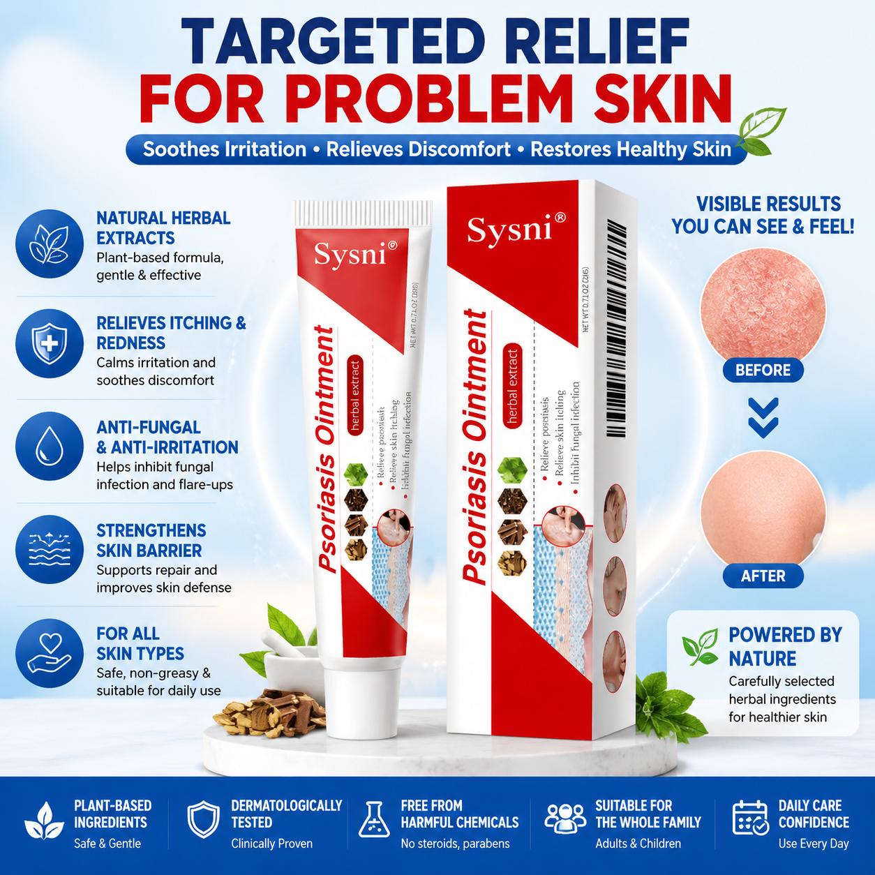 SYSNI Sensitive Skin Soothing Care Cream, Natural Botanical Formula, Helps Soothe Dryness, Itching and Redness, Suitable for Daily Sensitive Skin Care, Scalp Care and Skin Moisturizing Repair, Deep Hydration